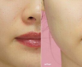 [EVENT] 환절기 피부고민 완전해방