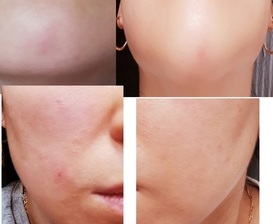 빠뜨 그리즈 리미티드 에디션