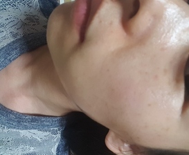 닥터윌리엄제이 프로젝트 프레쉬 블로운 마스크